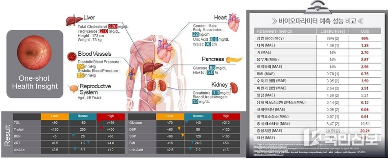 안저영상 기반 바이오 파라메타 예측 모델 및 성능